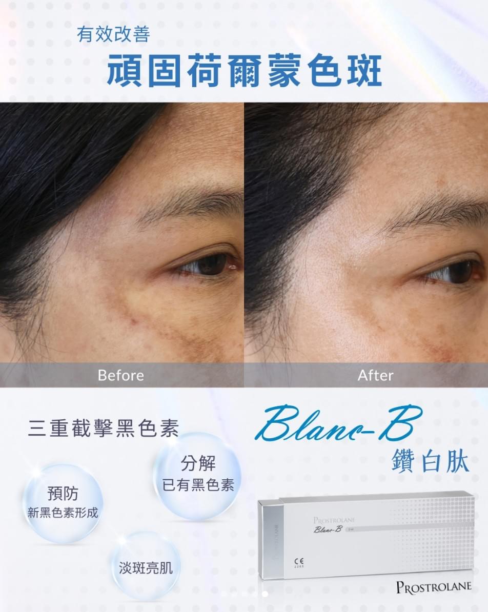 Professional medical beauty, show confidence's beauty Please create a one-page official website for a Hong Kong medical beauty brand.
Brand Name: Dr.Afterhour
Brand Subtitle: Afternoon Care Center
Brand Type: Medical Beauty Center
Website Language: Mainly Traditional Chinese, treatment names can be kept in English.
Target Audience: Women in Hong Kong aged 25–50 who focus on anti-aging, contour enhancement, skin quality improvement, and body management.
Please establish the following sections:
1. Hero Banner
2. About Brand Introduction
3. Treatments Categories
4. Featured Treatments
5. Why Choose Us
6. Consultation CTA
7. Contact Us
Main website goal:
Build a high-end medical aesthetic brand image, clearly display treatment categories, and guide customers to WhatsApp for inquiries and appointment assessments. Professional medical beauty, show confidence's beauty Please create a one-page official website for a Hong Kong medical beauty brand.
Brand Name: Dr.Afterhour
Brand Subtitle: Afternoon Care Center
Brand Type: Medical Beauty Center
Website Language: Mainly Traditional Chinese, treatment names can be kept in English.
Target Audience: Women in Hong Kong aged 25–50 who focus on anti-aging, contour enhancement, skin quality improvement, and body management.
Please establish the following sections:
1. Hero Banner
2. About Brand Introduction
3. Treatments Categories
4. Featured Treatments
5. Why Choose Us
6. Consultation CTA
7. Contact Us
Main website goal:
Build a high-end medical aesthetic brand image, clearly display treatment categories, and guide customers to WhatsApp for inquiries and appointment assessments.