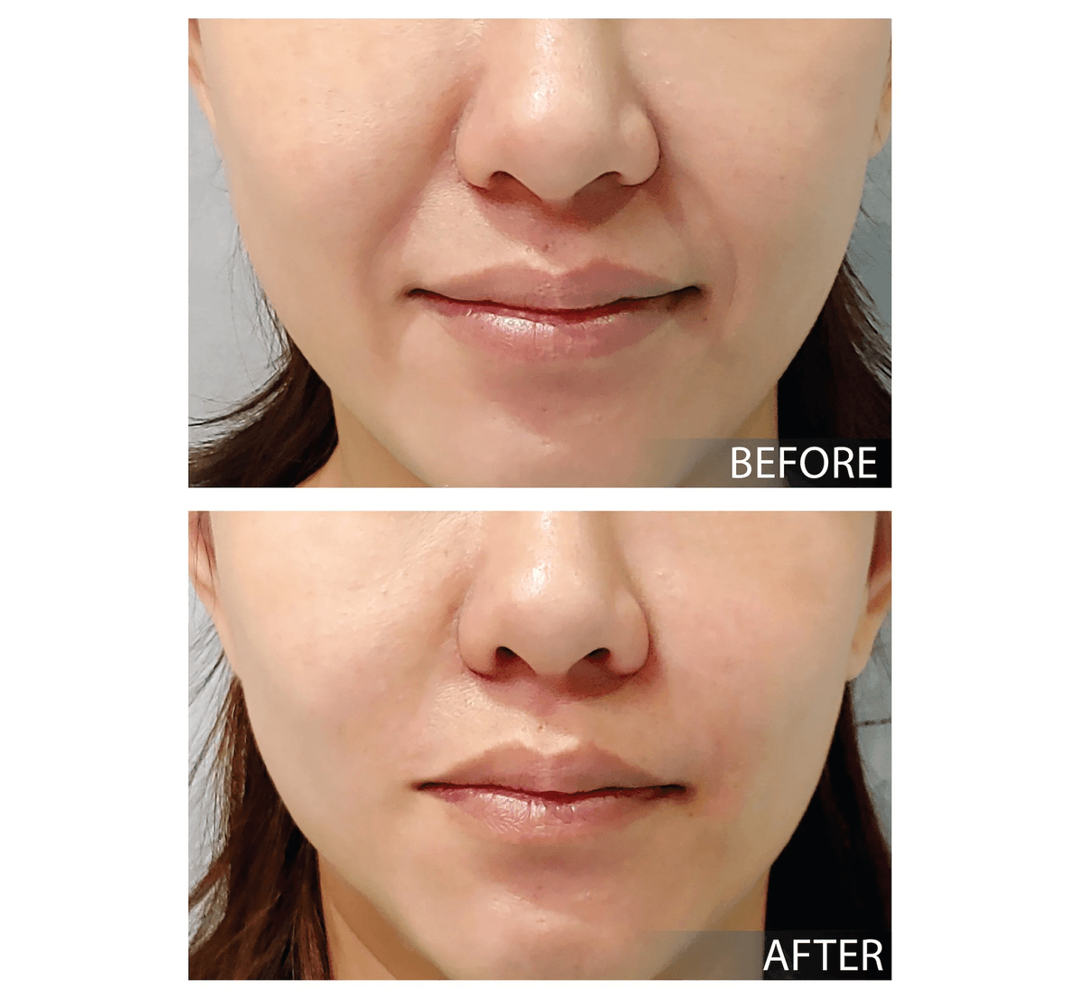 Please create a one-page official website for a Hong Kong medical beauty brand.
Brand Name: Dr.Afterhour
Brand Subname: Afternoon Care Center
Brand Type: Medical Beauty Center
Website Language: Mainly Traditional Chinese, treatment names can be kept in English.
Target Audience: Women in Hong Kong aged 25–50 who focus on anti-aging, contour enhancement, skin quality improvement, and body management.
Please establish the following sections:
1. Hero Banner
2. About Brand Introduction
3. Treatments Classification
4. Featured Treatments
5. Why Choose Us
6. Consultation CTA
7. Contact Us
Main website goal:
Build a high-end medical aesthetic brand image, clearly display treatment classifications, and guide customers to WhatsApp for inquiries and appointment assessments.