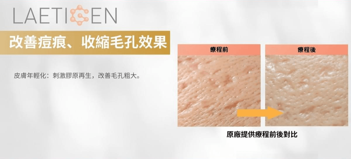 Professional medical beauty, show confidence's beauty Please create a one-page official website for a Hong Kong medical beauty brand.
Brand Name: Dr.Afterhour
Brand Subtitle: Afternoon Care Center
Brand Type: Medical Beauty Center
Website Language: Mainly Traditional Chinese, treatment names can be kept in English.
Target Audience: Women in Hong Kong aged 25–50 who focus on anti-aging, contour enhancement, skin quality improvement, and body management.
Please establish the following sections:
1. Hero Banner
2. About Brand Introduction
3. Treatments Categories
4. Featured Treatments
5. Why Choose Us
6. Consultation CTA
7. Contact Us
Main website goal:
Build a high-end medical aesthetic brand image, clearly display treatment categories, and guide customers to WhatsApp for inquiries and appointment assessments. Professional medical beauty, show confidence's beauty Please create a one-page official website for a Hong Kong medical beauty brand.
Brand Name: Dr.Afterhour
Brand Subtitle: Afternoon Care Center
Brand Type: Medical Beauty Center
Website Language: Mainly Traditional Chinese, treatment names can be kept in English.
Target Audience: Women in Hong Kong aged 25–50 who focus on anti-aging, contour enhancement, skin quality improvement, and body management.
Please establish the following sections:
1. Hero Banner
2. About Brand Introduction
3. Treatments Categories
4. Featured Treatments
5. Why Choose Us
6. Consultation CTA
7. Contact Us
Main website goal:
Build a high-end medical aesthetic brand image, clearly display treatment categories, and guide customers to WhatsApp for inquiries and appointment assessments.