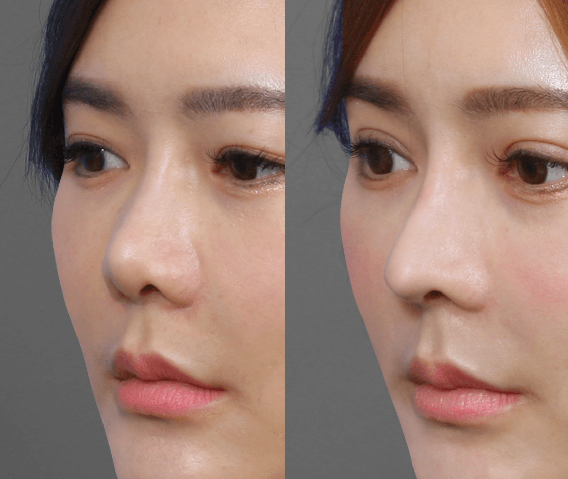 Immediately reserve free consultation, for your skin and figure tailor-made exclusive plan, radiate youthful glow. Professional medical beauty, show confidence's beauty Please create a one-page official website for a Hong Kong medical beauty brand.
Brand Name: Dr.Afterhour
Brand Subname: Afternoon Care Center
Brand Type: Medical Beauty Center
Website Language: Mainly Traditional Chinese, treatment names can be kept in English.
Target Audience: Women in Hong Kong aged 25–50 who focus on anti-aging, contour enhancement, skin quality improvement, and body management.
Please establish the following sections:
1. Hero Banner
2. About Brand Introduction
3. Treatments Classification
4. Featured Treatments
5. Why Choose Us
6. Consultation CTA
7. Contact Us
Main website goal:
Build a high-end medical aesthetic brand image, clearly display treatment classifications, and guide customers to WhatsApp for inquiries and appointment assessments. Immediately reserve free consultation, for your skin and figure tailor-made exclusive plan, radiate youthful glow. Professional medical beauty, show confidence's beauty Please create a one-page official website for a Hong Kong medical beauty brand.
Brand Name: Dr.Afterhour
Brand Subname: Afternoon Care Center
Brand Type: Medical Beauty Center
Website Language: Mainly Traditional Chinese, treatment names can be kept in English.
Target Audience: Women in Hong Kong aged 25–50 who focus on anti-aging, contour enhancement, skin quality improvement, and body management.
Please establish the following sections:
1. Hero Banner
2. About Brand Introduction
3. Treatments Classification
4. Featured Treatments
5. Why Choose Us
6. Consultation CTA
7. Contact Us
Main website goal:
Build a high-end medical aesthetic brand image, clearly display treatment classifications, and guide customers to WhatsApp for inquiries and appointment assessments.