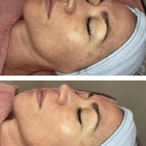 Alkaline Wash and Enzyme Mask Alkaline Wash and Enzyme Mask