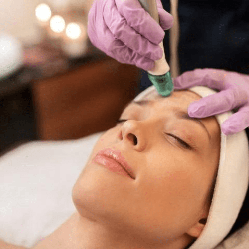 Microdermabrasion Microdermabrasion