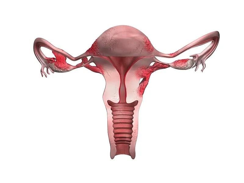 Section image