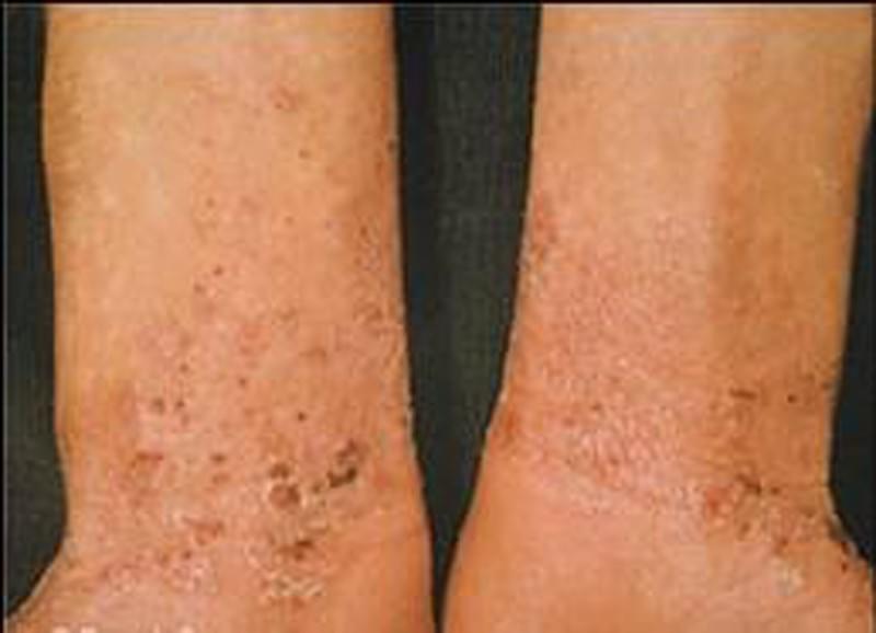 The Tuina massage is an effective form of manual therapy that relieves tension, promotes circulation, and harmonizes the energy flows in the body. Ideal for supporting recovery and for stress reduction. Tuina Massage Our services Traditional Chinese Medicine, acupuncture, moxibustion, tui na, cupping, Chinese herbal medicine The Tuina massage is an effective form of manual therapy that relieves tension, promotes circulation, and harmonizes the energy flows in the body. Ideal for supporting recovery and for stress reduction. Tuina Massage Our services Traditional Chinese Medicine, acupuncture, moxibustion, tui na, cupping, Chinese herbal medicine