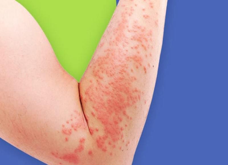 — Thomas Kraus I was skeptical about traditional Chinese medicine, but the results were convincing. The herbal therapy has brought back my energy. Our practice has supported over 1000 patients on their way to health. Traditional Chinese Medicine, acupuncture, moxibustion, tui na, cupping, Chinese herbal medicine — Thomas Kraus I was skeptical about traditional Chinese medicine, but the results were convincing. The herbal therapy has brought back my energy. Our practice has supported over 1000 patients on their way to health. Traditional Chinese Medicine, acupuncture, moxibustion, tui na, cupping, Chinese herbal medicine