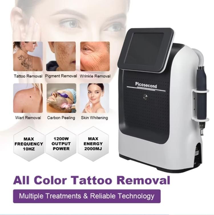Portable Picocond Pigment & Tattoo Removal System