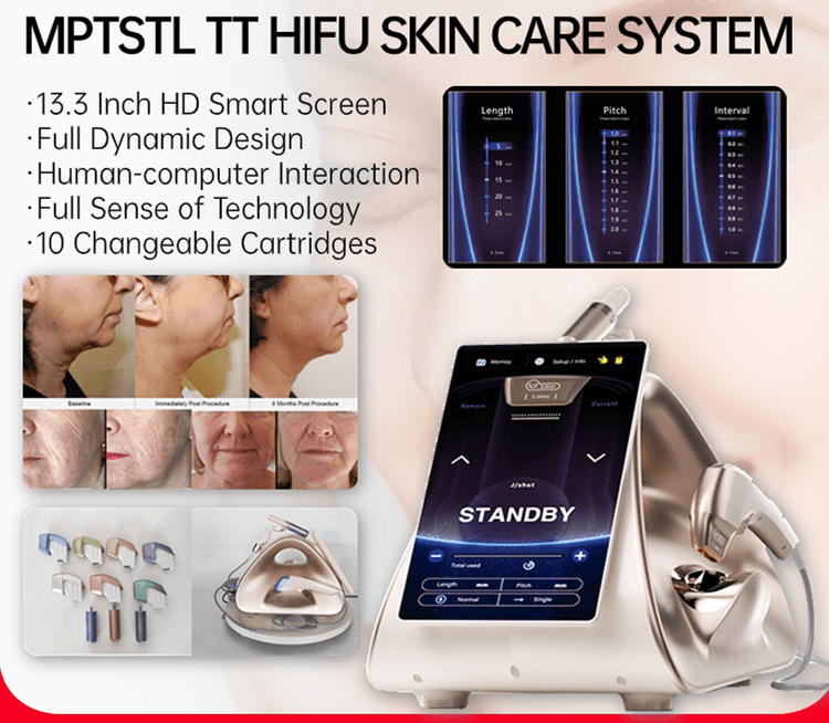 HIFU Face & Body Care System TT MPTSTL