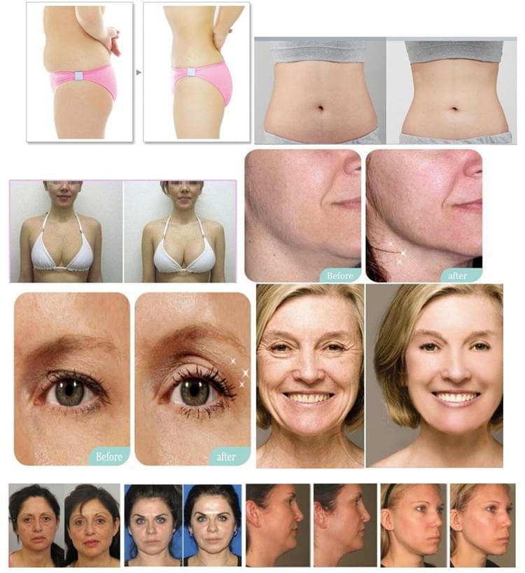 V-MAX Skin Care System