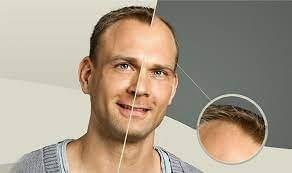 broken image