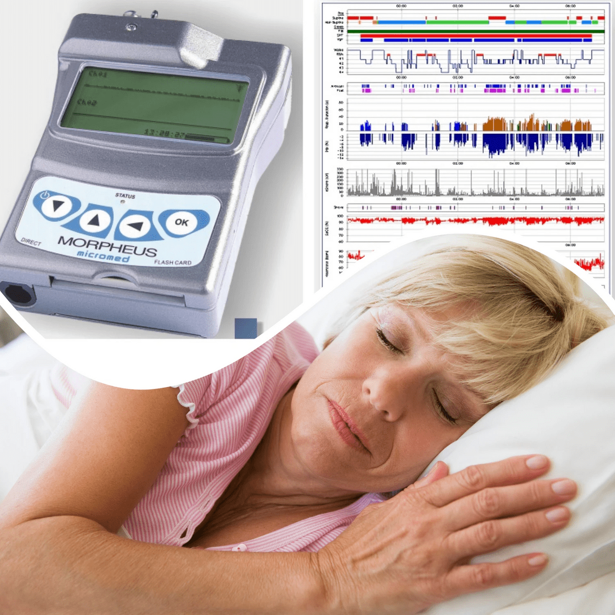 Movilsalud, realizamos Polisomnografia en el domicilio Movilsalud, realizamos Polisomnografia en el domicilio