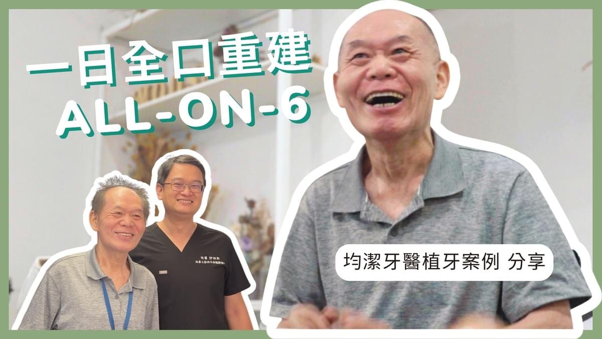 台北/新北All-On-6一日全口植牙重建案例,均潔牙醫診所 台北/新北All-On-6一日全口植牙重建案例,均潔牙醫診所