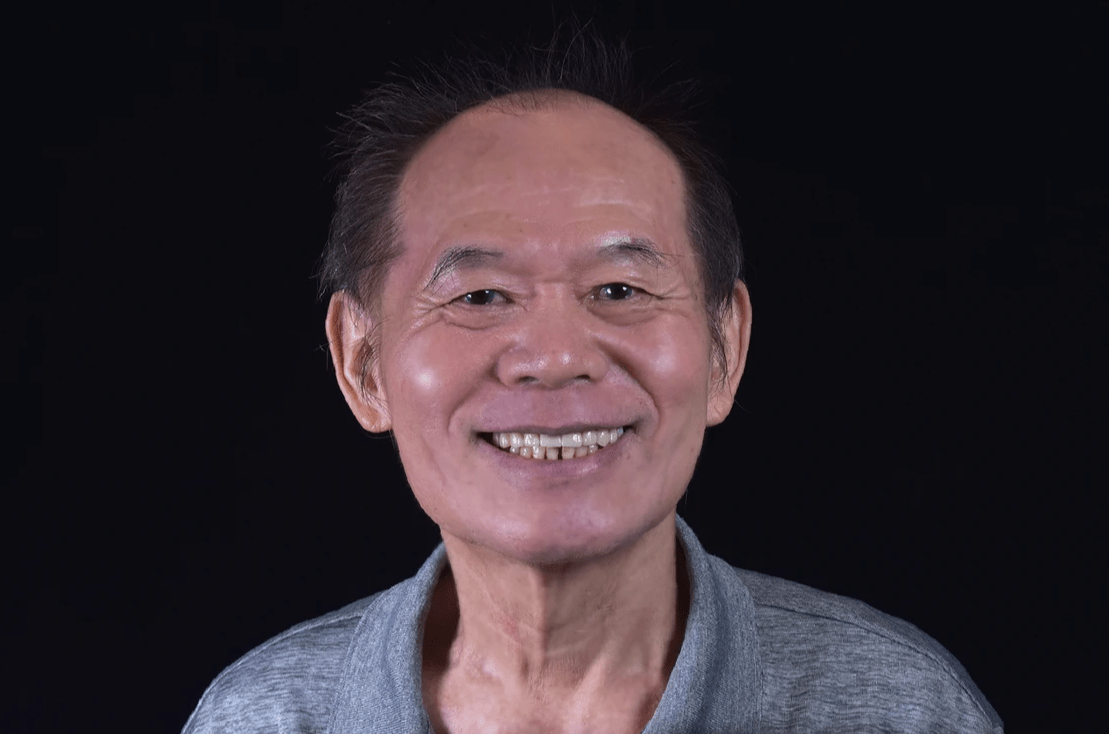 均潔牙醫診所,allon4案例 均潔牙醫診所,allon4案例