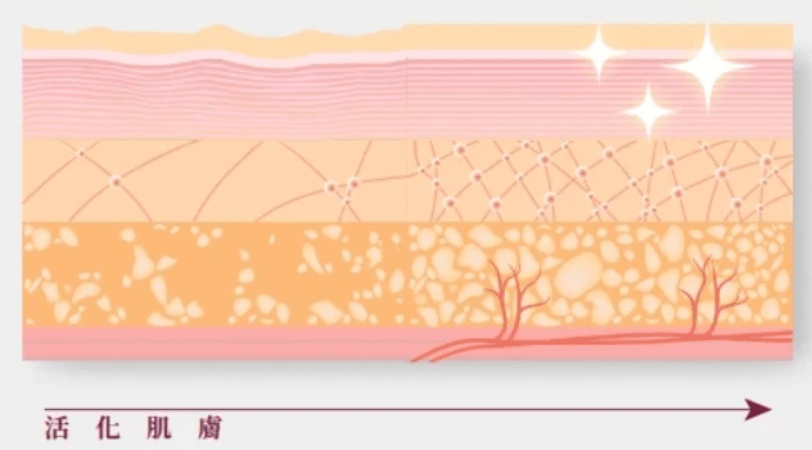 4D舒顏萃舒顏萃同時也能活化肌膚組織微血管,優化膚質喚醒肌膚青春能量,施打後肌膚會更加粉嫩透亮。 4D舒顏萃舒顏萃同時也能活化肌膚組織微血管,優化膚質喚醒肌膚青春能量,施打後肌膚會更加粉嫩透亮。