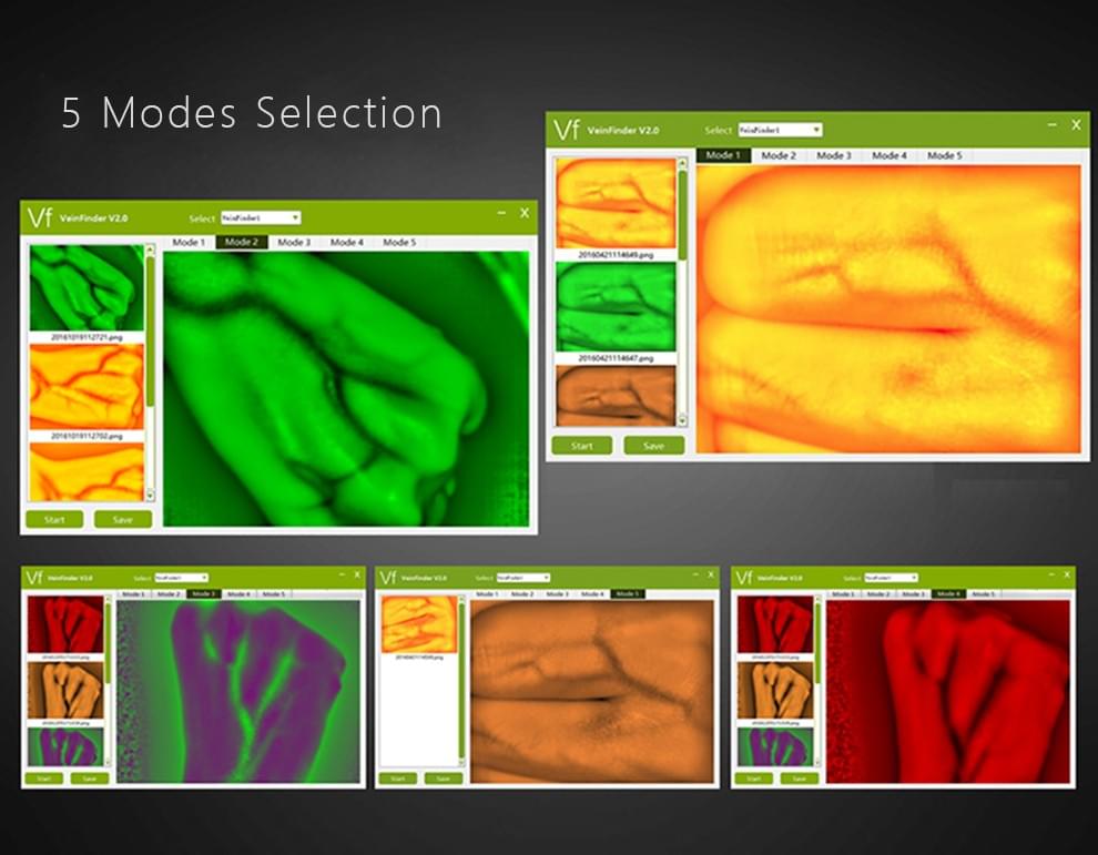 ZY500 Computer-Based Infrared Vein Finder