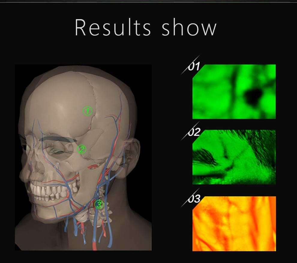 ZY500 Computer-Based Infrared Vein Finder