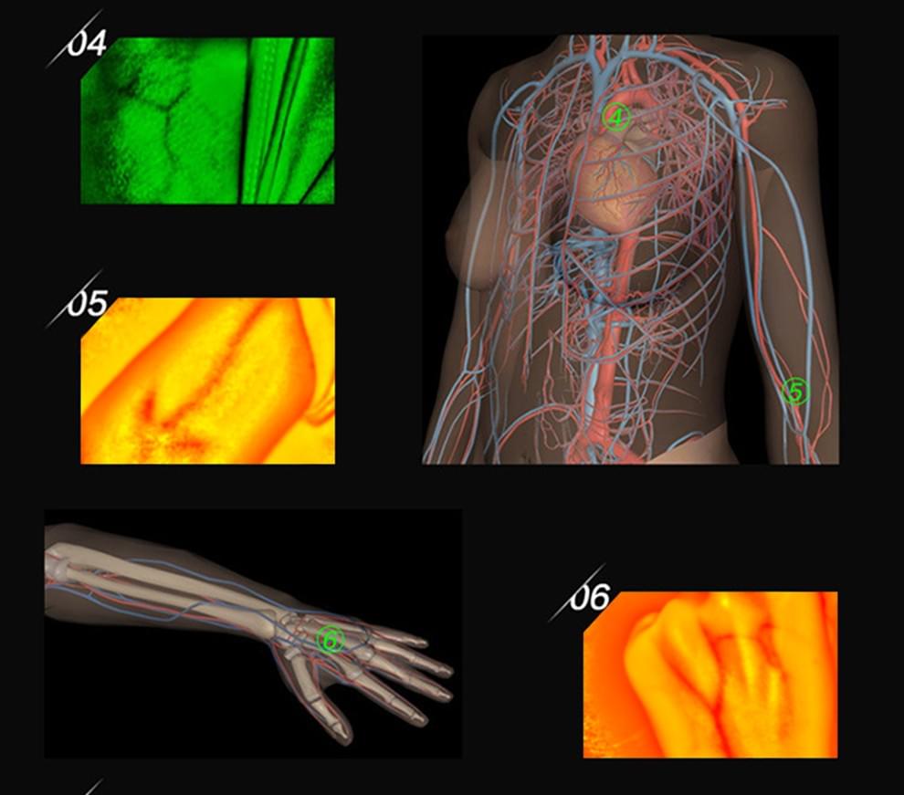 ZY500 Computer-Based Infrared Vein Finder