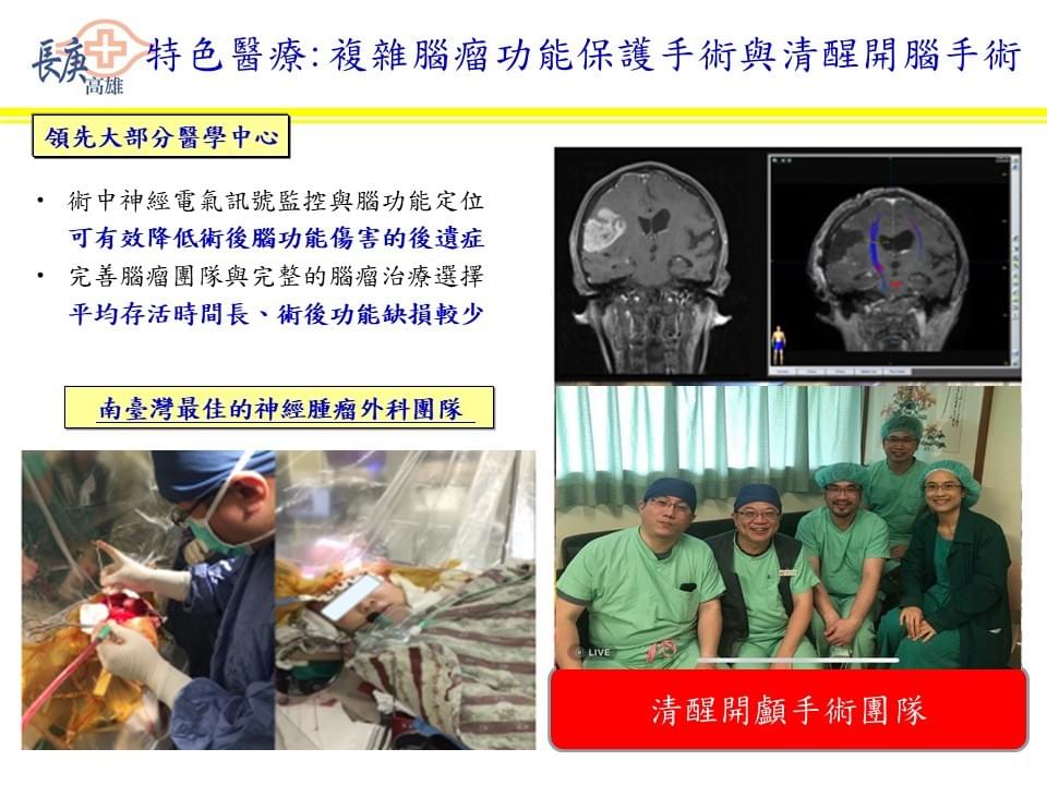 腦瘤專家莊銘榮醫師 腦瘤專家莊銘榮醫師