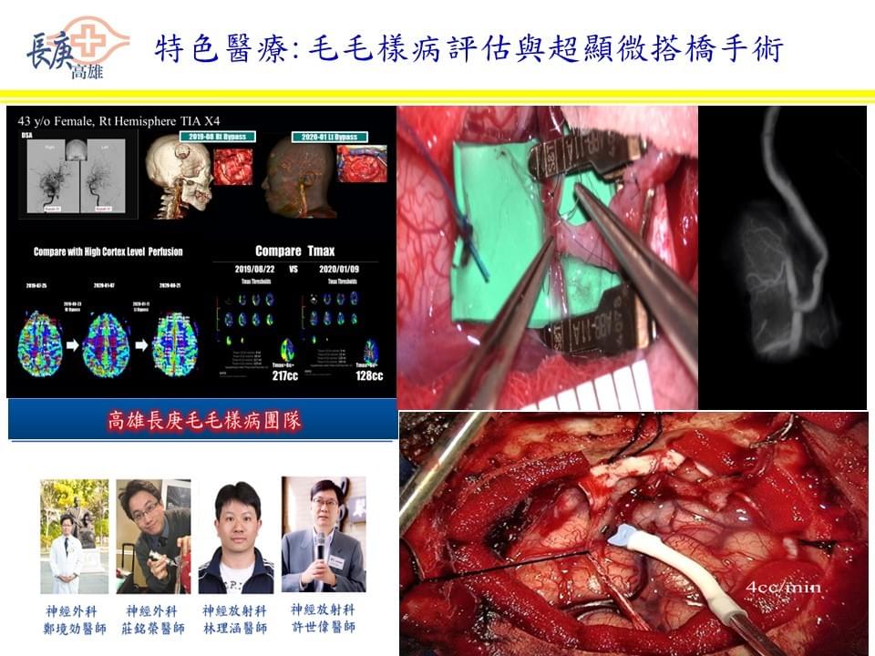毛毛樣病莊銘榮醫師 毛毛樣病莊銘榮醫師