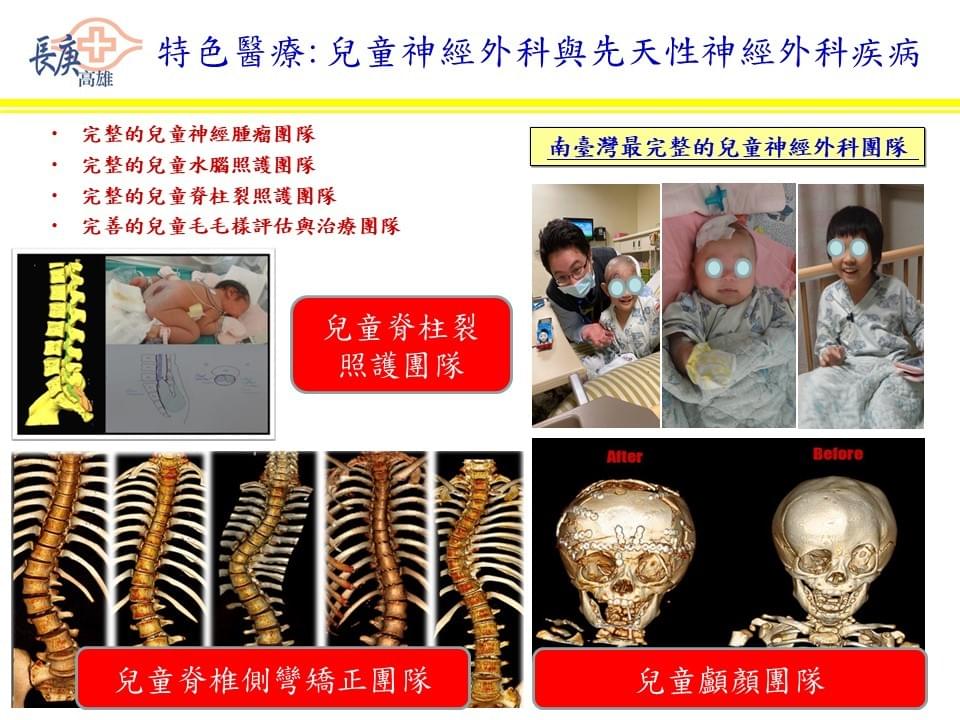 兒童神經外科莊銘榮醫師 兒童神經外科莊銘榮醫師