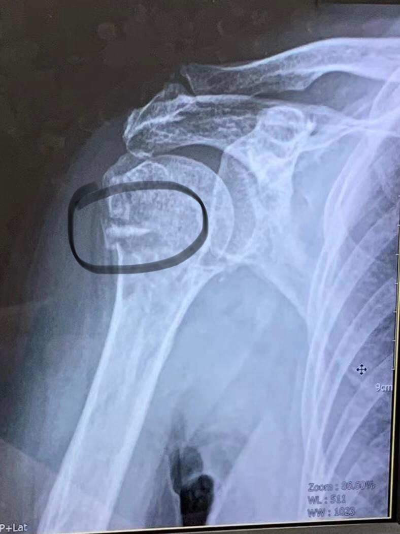 broken image