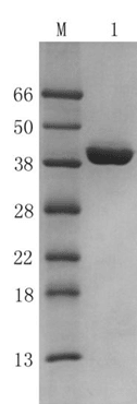 Recombinant Peptostreptococcus magnus Protein L (r-PPL)
