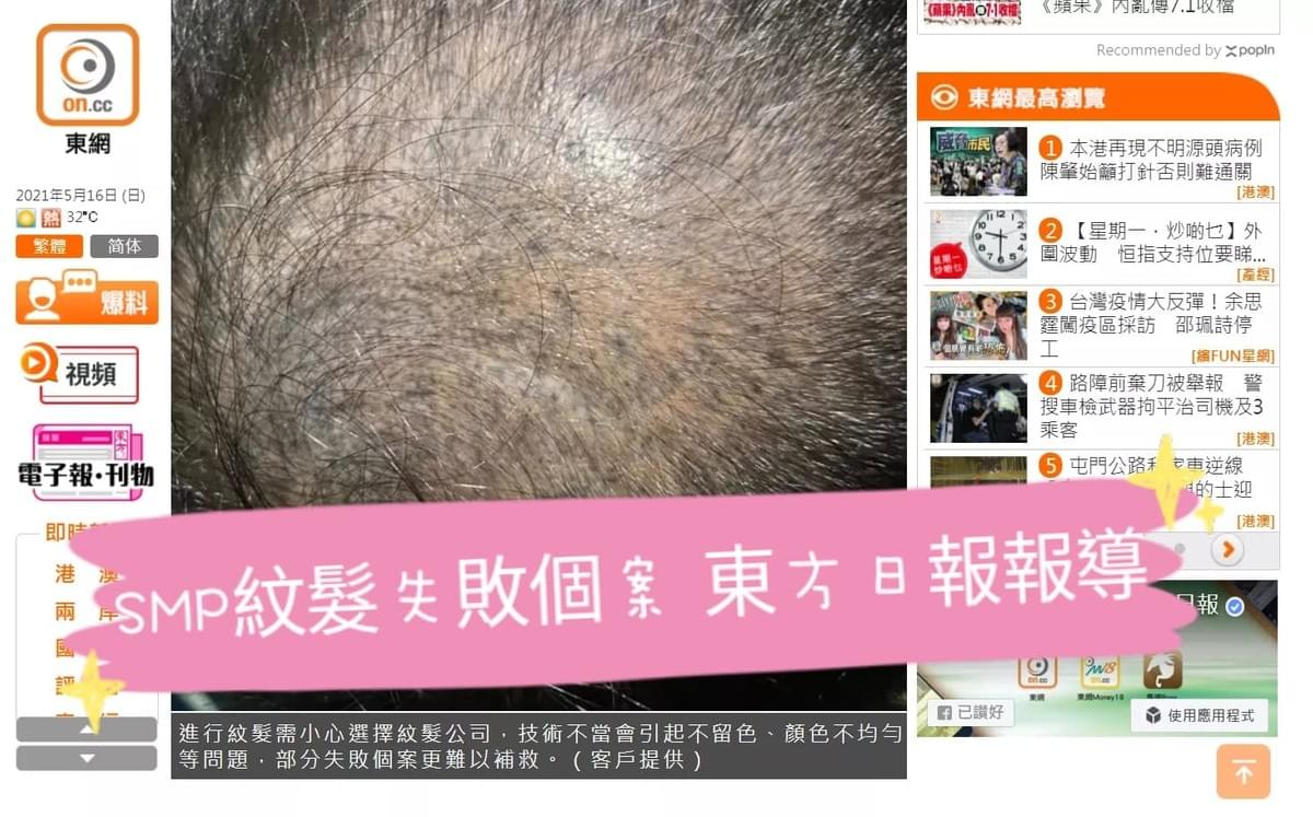 SMP紋髮 紋髮失敗個案 SMP紋髮 紋髮失敗個案