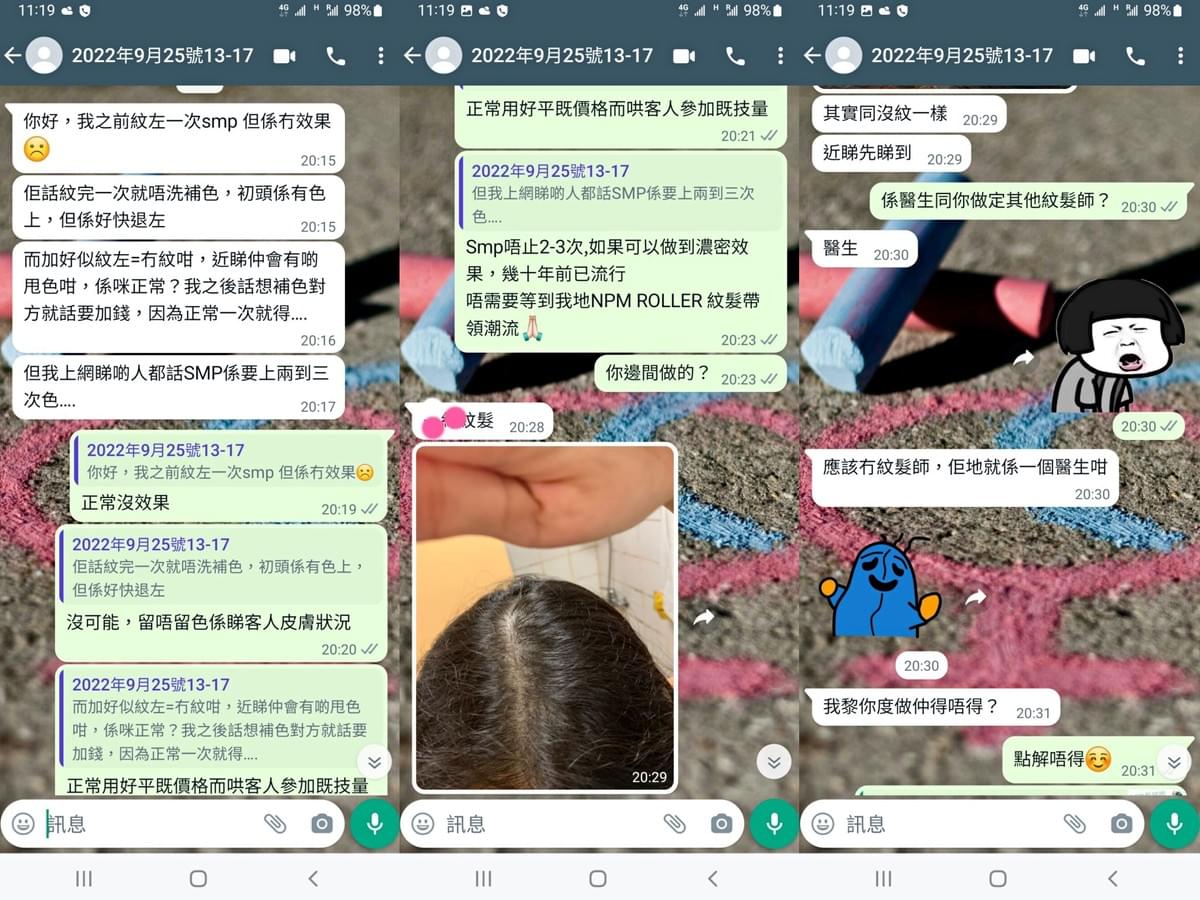 SMP紋髮 紋髮失敗個案 SMP紋髮 紋髮失敗個案