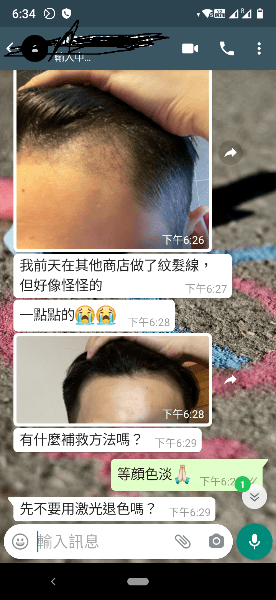 SMP紋髮 紋髮失敗個案 SMP紋髮 紋髮失敗個案