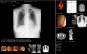 醫學影像PACS 醫學影像PACS