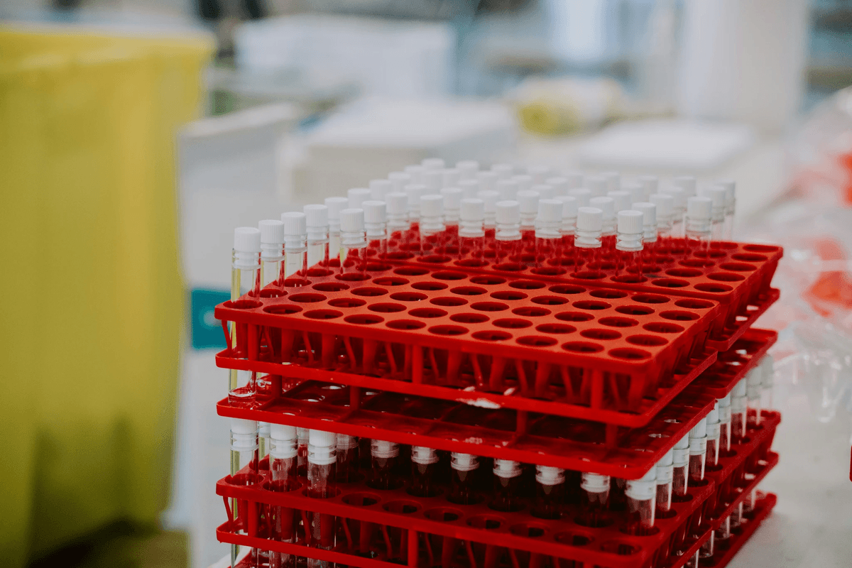 LFGB Test conducted by professionals analyzing general plastic products LFGB Test conducted by professionals analyzing general plastic products