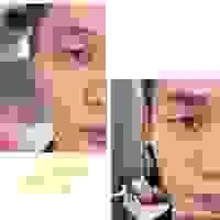 broken image