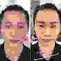 broken image