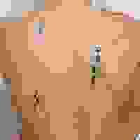 broken image