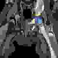 Infant hip 3D model from MRI
