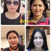 ลักยิ้ม