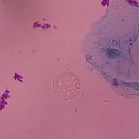 Trichomonas vaginalis