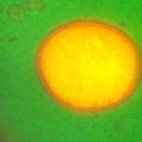 Toxocara cannis