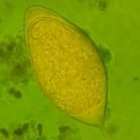 Schistossoma haematobium
