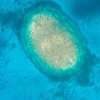 Ascaris galli