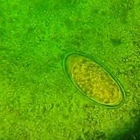 Enterobius