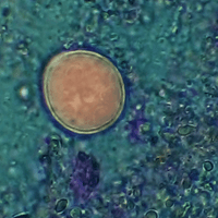 E.coli