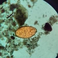 Fasciola hepatica (Brasil)