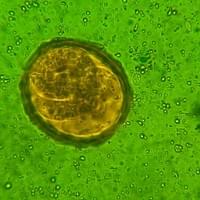  Ascaris