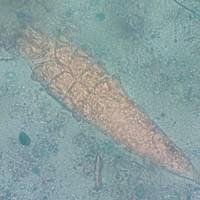 Demodex folliculorum