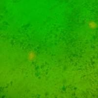Giardia 