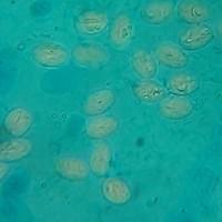 Giardia