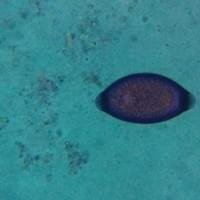 Trichuris