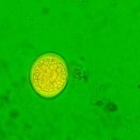 Cystoisospora