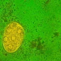 Ancylostoma