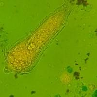 S. haematobium  miracidium